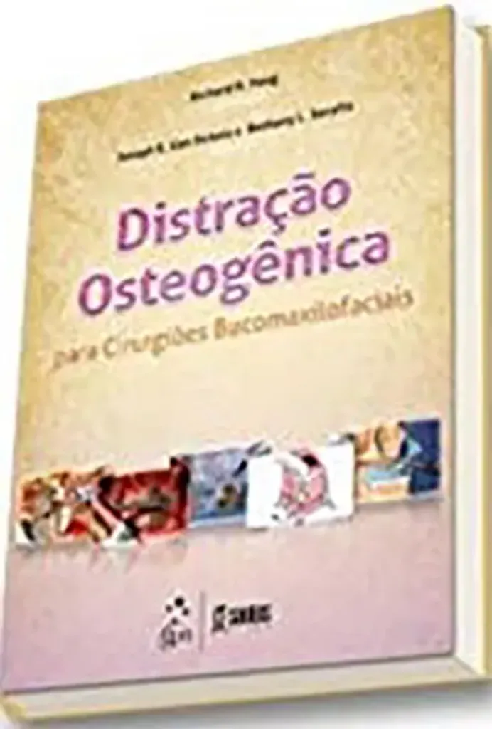 Imagem de Distração Osteogênica para Cirurgiões Bucomaxilofaciais