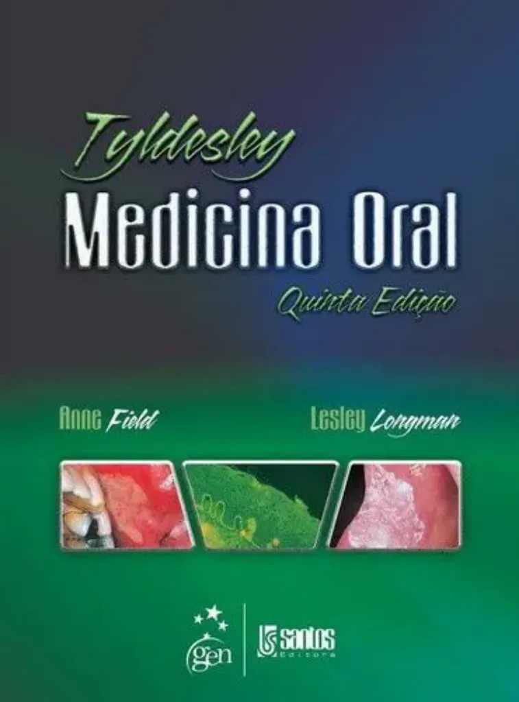 Imagem de Medicina Oral de Tyldesley's