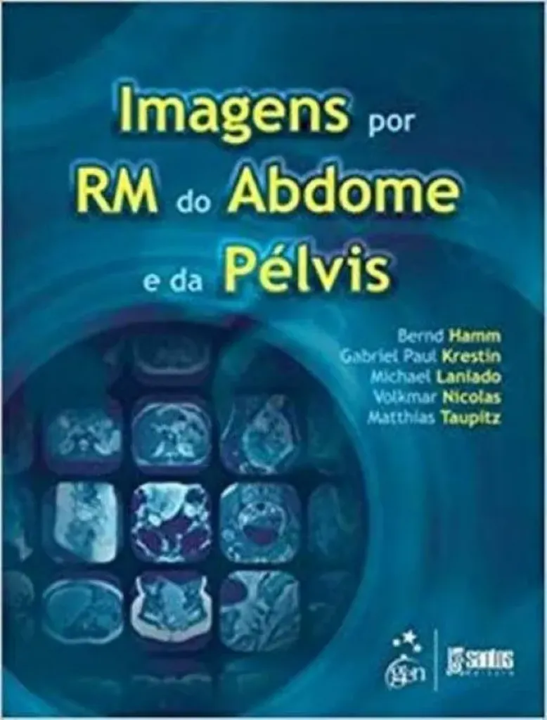 Imagem de Imagens por RM do Abdomen e da Pelvis