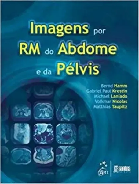 Imagem de Imagens por RM do Abdomen e da Pelvis