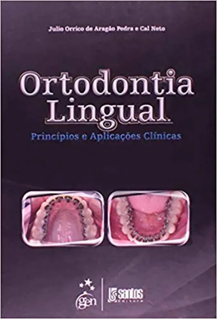Imagem de Ortodontia Lingual Princípios e Aplicações Clínicas