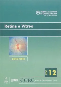 Imagem de Retina e Vítreo