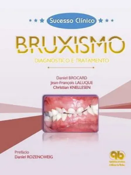 Imagem de Sucesso Clínico Bruxismo - Diagnóstico e Tratamento
