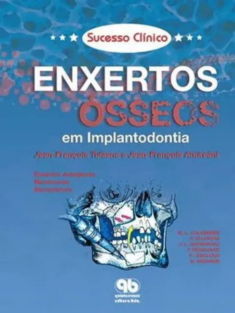 Imagem de Sucesso Clínico - Enxertos Ósseos em Implantodontia