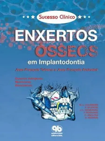 Imagem de Sucesso Clínico - Enxertos Ósseos em Implantodontia