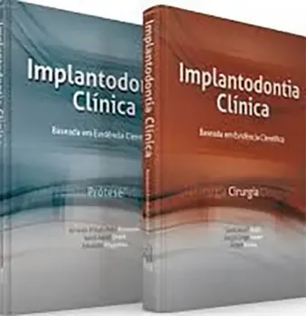 Imagem de Implantodontia Vol. 1 Clínica Baseada em Evidência Científica + Implantodontia Vol. 2 Clínica Baseada em Evidência Científica