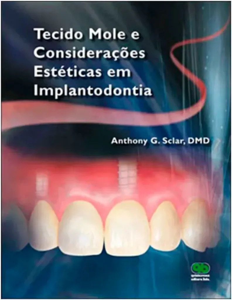 Picture of Book Tecido Mole e Considerações Estéticas em Implantodontia