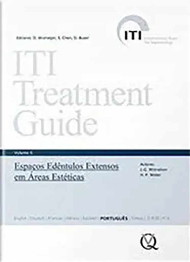 Imagem de ITI Treatment Guide: Espaços Edêntulos Extensos em Áreas Estéticas Vol. 6