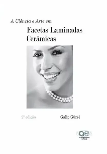 Imagem de Facetas Laminadas Cerâmicas
