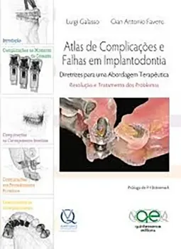 Imagem de Atlas de Complicações e Falhas em Implantodontia
