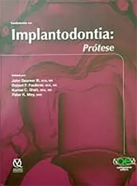 Imagem de Fundamentos em Implantodontia: Prótese