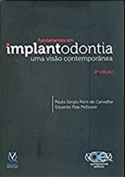 Imagem de Fundamentos em Implantodontia - Uma Visão Contemporânea