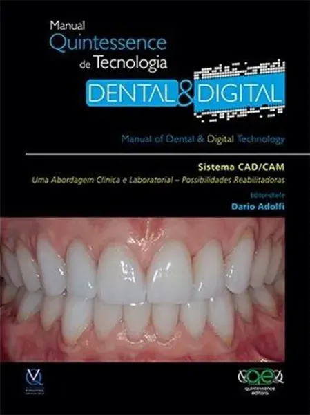 Imagem de Sistema Cad-Cam - Uma Abordagem Clinica e Laboratorial