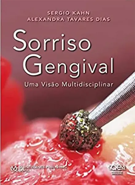 Imagem de Sorriso Gengival - Uma Visão Multidisciplinar
