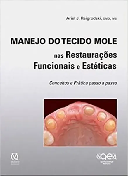 Imagem de Manejo do Tecido Mole nas Restaurações Funcionais e Estéticas