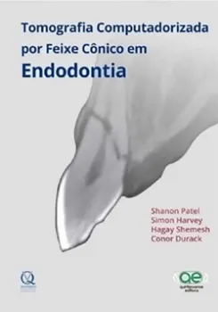 Imagem de Tomografia Computadorizada por Feixe Cônico em Endodontia