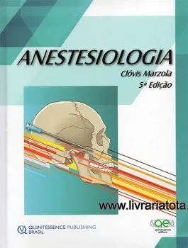 Imagem de Anestesiologia de Marzola