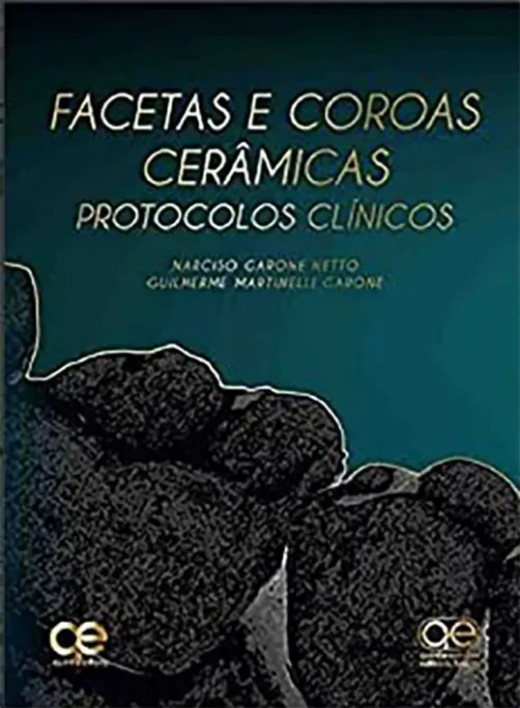 Imagem de Facetas e Coroas Cerâmicas - Protocolos Clínicos