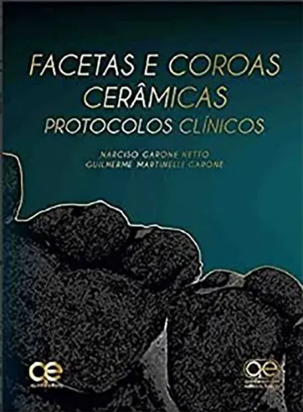 Imagem de Facetas e Coroas Cerâmicas - Protocolos Clínicos