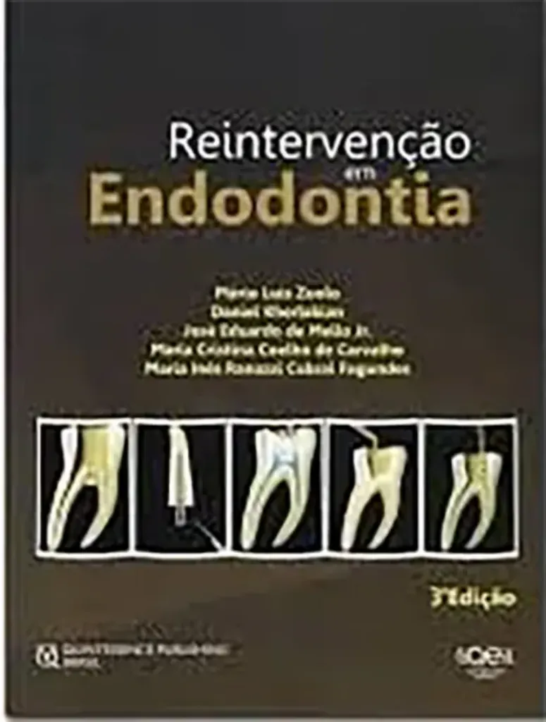Imagem de Reintervenção em Endodontia