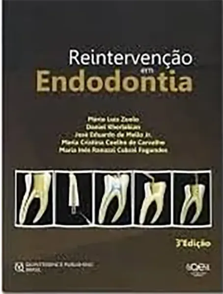 Imagem de Reintervenção em Endodontia