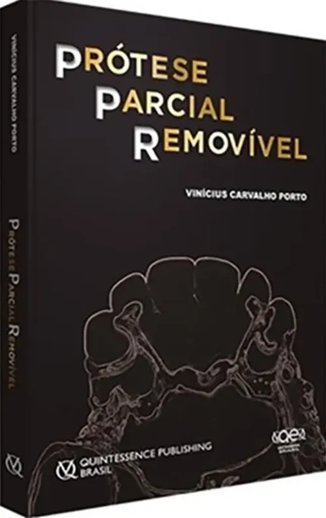 Imagem de Prótese Parcial Removível