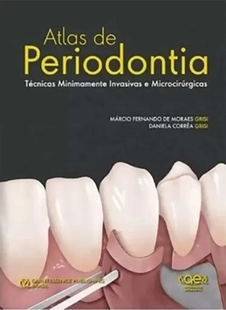 Imagem de Atlas de Periodontia