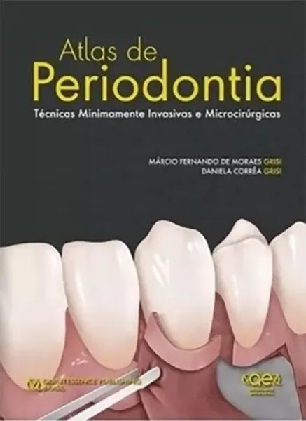 Imagem de Atlas de Periodontia