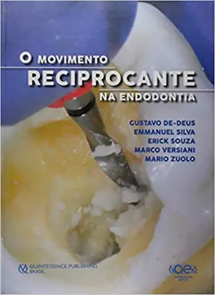 Imagem de O Movimento Reciprocante na Endodontia