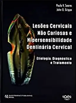 Imagem de Lesões Cervicais Não Cariosas e Hipersensibilidade Dentinária Cervical: Etiologia, Diagnóstico e Tratamento