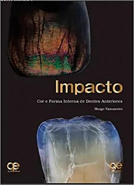 Imagem de Impacto - Cor e Forma Interna de Dentes Anteriores (Edição Bilingue)