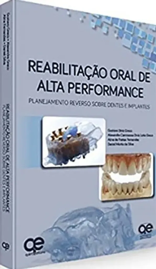 Imagem de Reabilitação Oral de Alta Performance: Planejamento Reverso Sobre Dentes e Implantes