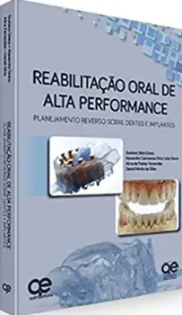 Imagem de Reabilitação Oral de Alta Performance: Planejamento Reverso Sobre Dentes e Implantes