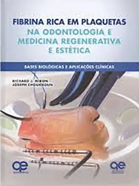 Imagem de Fibrina Rica em Plaquetas na Odontologia Regenerativa - Base Biológica - Aplicações Clínicas e Estéticas