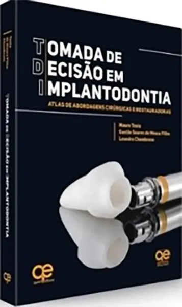 Imagem de Tomada de Decisão em Implantodontia: Atlas de Abordagens Cirúrgicas e Restauradoras