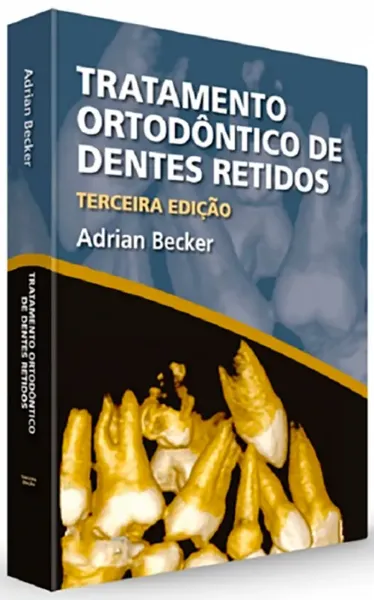 Imagem de Tratamento Ortodôntico de Dentes Retidos