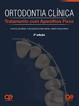 Imagem de Ortodontia Clínica Tratamento com Aparelhos Fixos