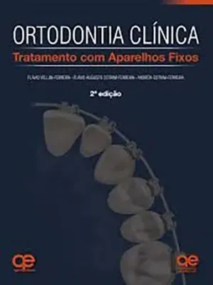 Imagem de Ortodontia Clínica Tratamento com Aparelhos Fixos