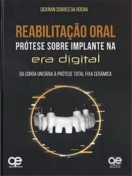 Picture of Book Reabilitação Oral: Prótese Sobre Implante na Era Digital - Da Coroa Unitária à Prótese Total Fixa Cerâmica