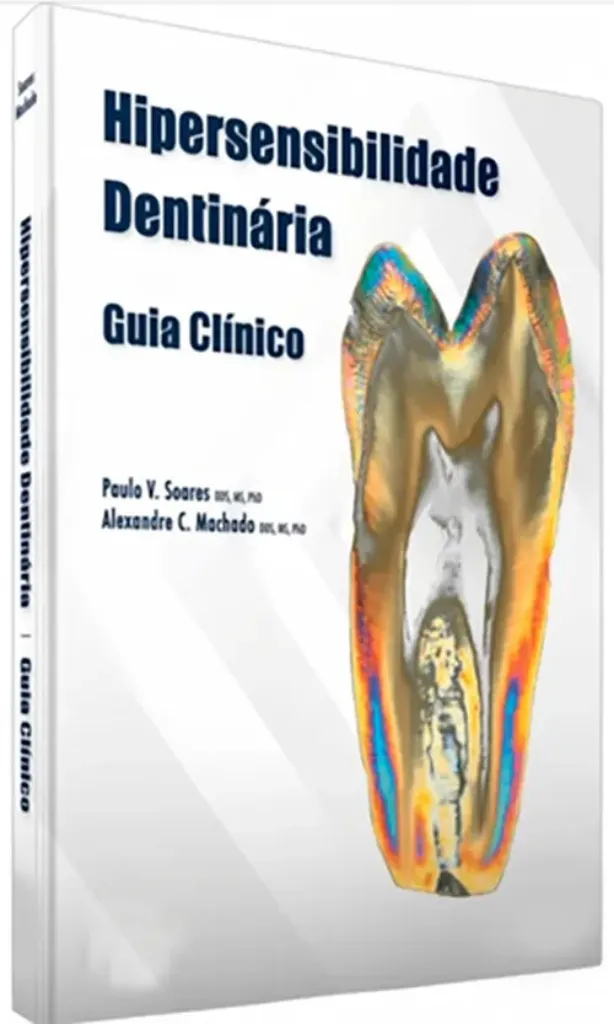 Imagem de Hipersensibilidade Dentinária - Guia Clínico