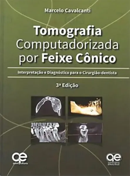 Imagem de Tomografia Computadorizada por Feixe Cônico