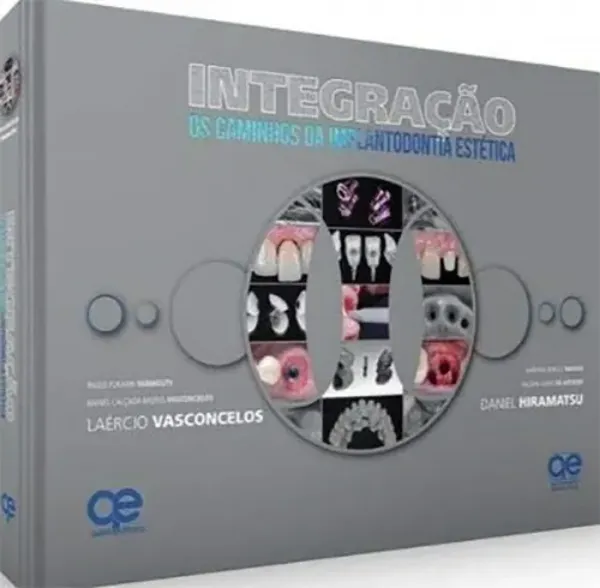 Imagem de Integração: Os Caminhos da Implantodontia Estética