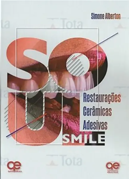 Imagem de Soul Smile: Restaurações Cerâmicas Adesivas
