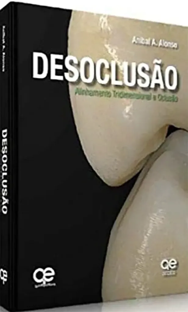 Imagem de Desoclusão: Alinhamento Tridimensional e Oclusão