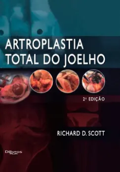 Picture of Book Artroplastia Total do Joelho