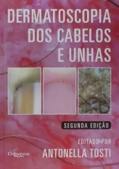 Picture of Book Dermatoscopia dos Cabelos e Unhas