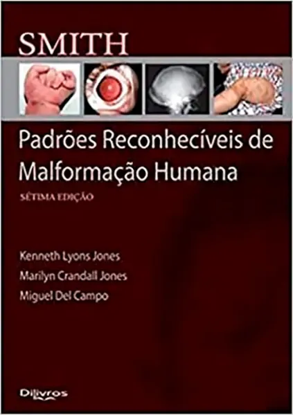 Imagem de Smith Padrões Reconhecíveis de Malformação Humana