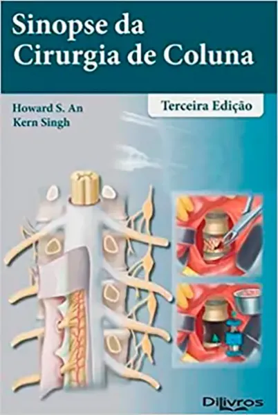 Imagem de Sinopse da Cirurgia de Coluna