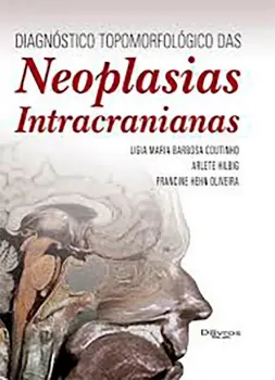 Imagem de Diagnóstico Topomorfológico Neoplasias Intracranianas