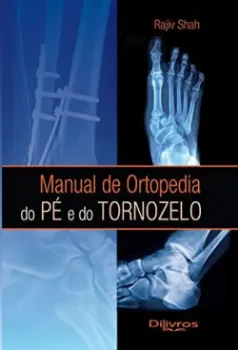 Imagem de Manual de Ortopedia do Pé e do Tornozelo
